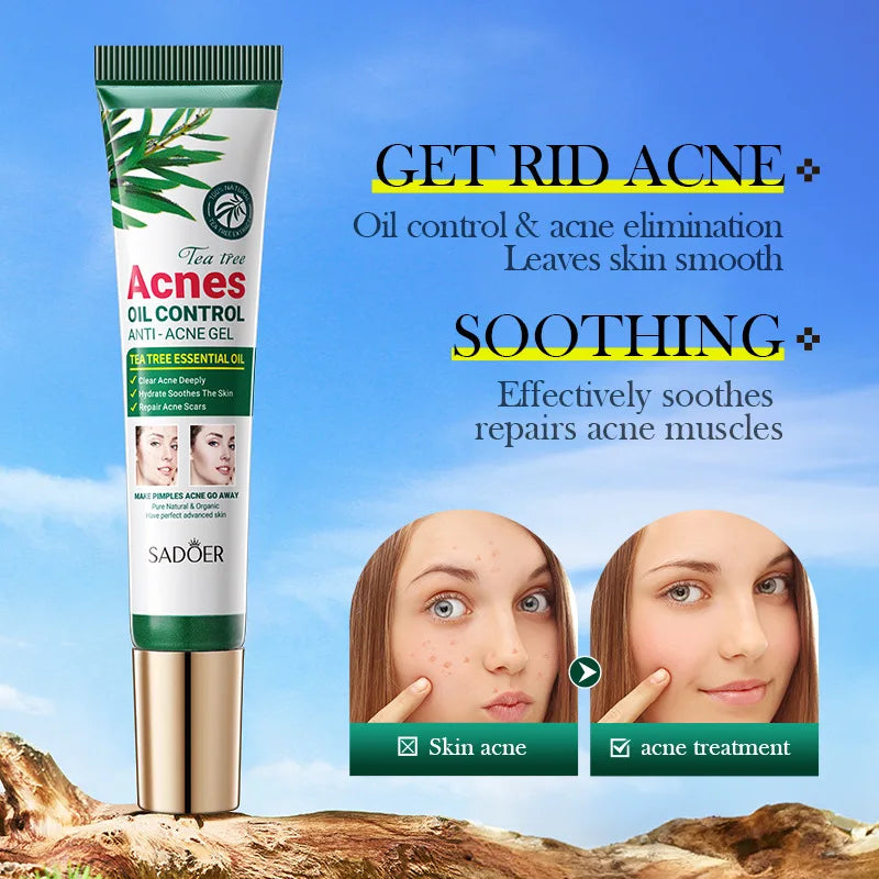 Tea Tree Acne Removing Cream Facial skincare Oil Control Face Gel Creams Hydrating Moisturizing Facial Cream Skin Care Set