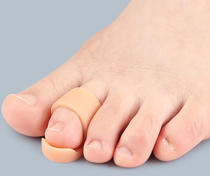 2pcs Set of Hammer Shaped Toes, Used for Curling, Bending, And Claw Shaped Toe Lifting, Toe Tips, And Toe Pads
