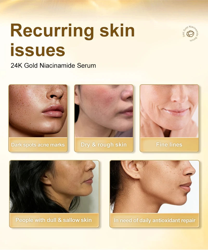 AUQUEST Niacinamide Face Serum Whitening Dark Spot Remover 24K Gold Serum Hyaluronic Acid Anit-Wrinkle Facial Serum Skin Care