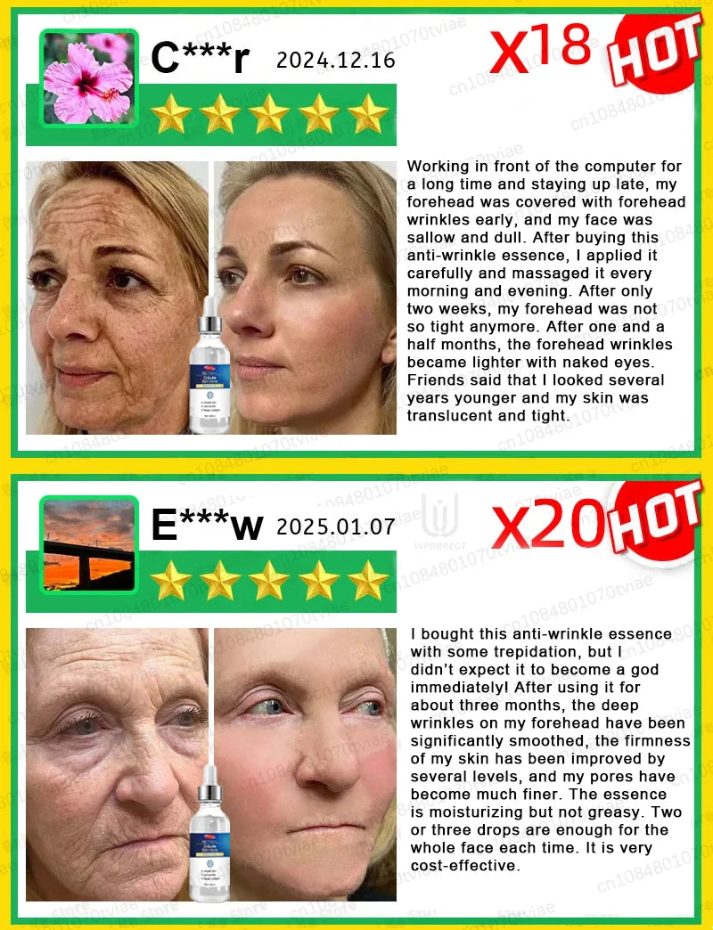 Anti-wrinkle facial essence anti-aging anti-wrinkle essence brightening and firming whitening moisturizing skin care