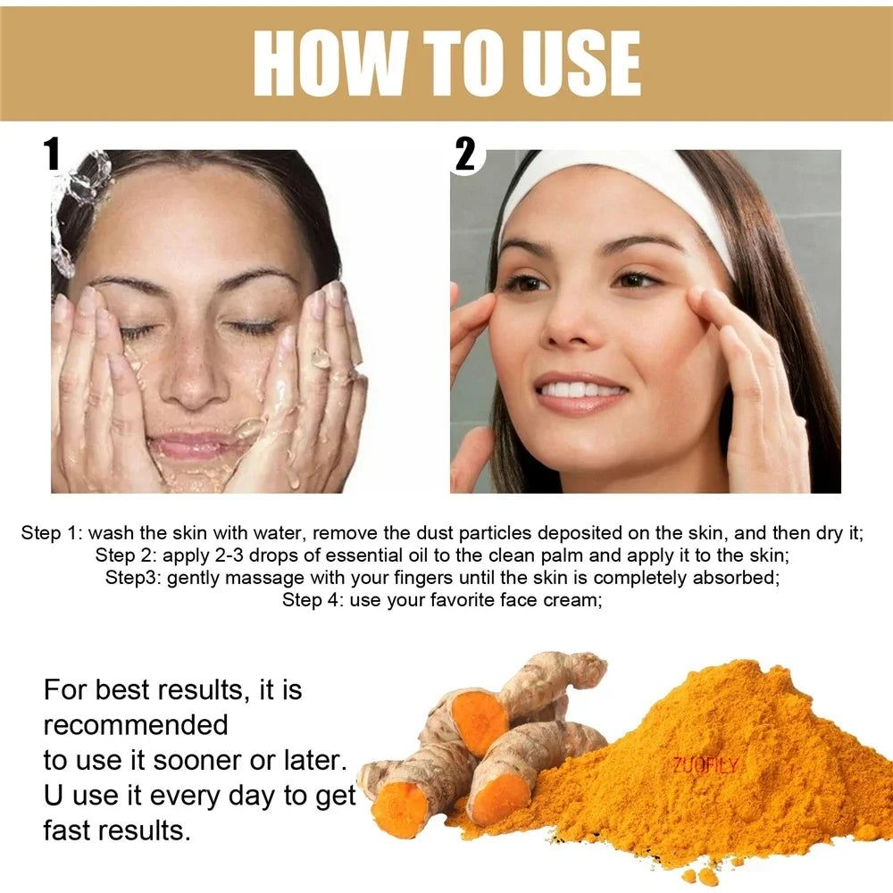 Turmeric Whitening Freckles Serum Remove Dark Spots Melasma Brighten Lighten Melanin Improve Dull Anti-aging Face Skin Care 10ml