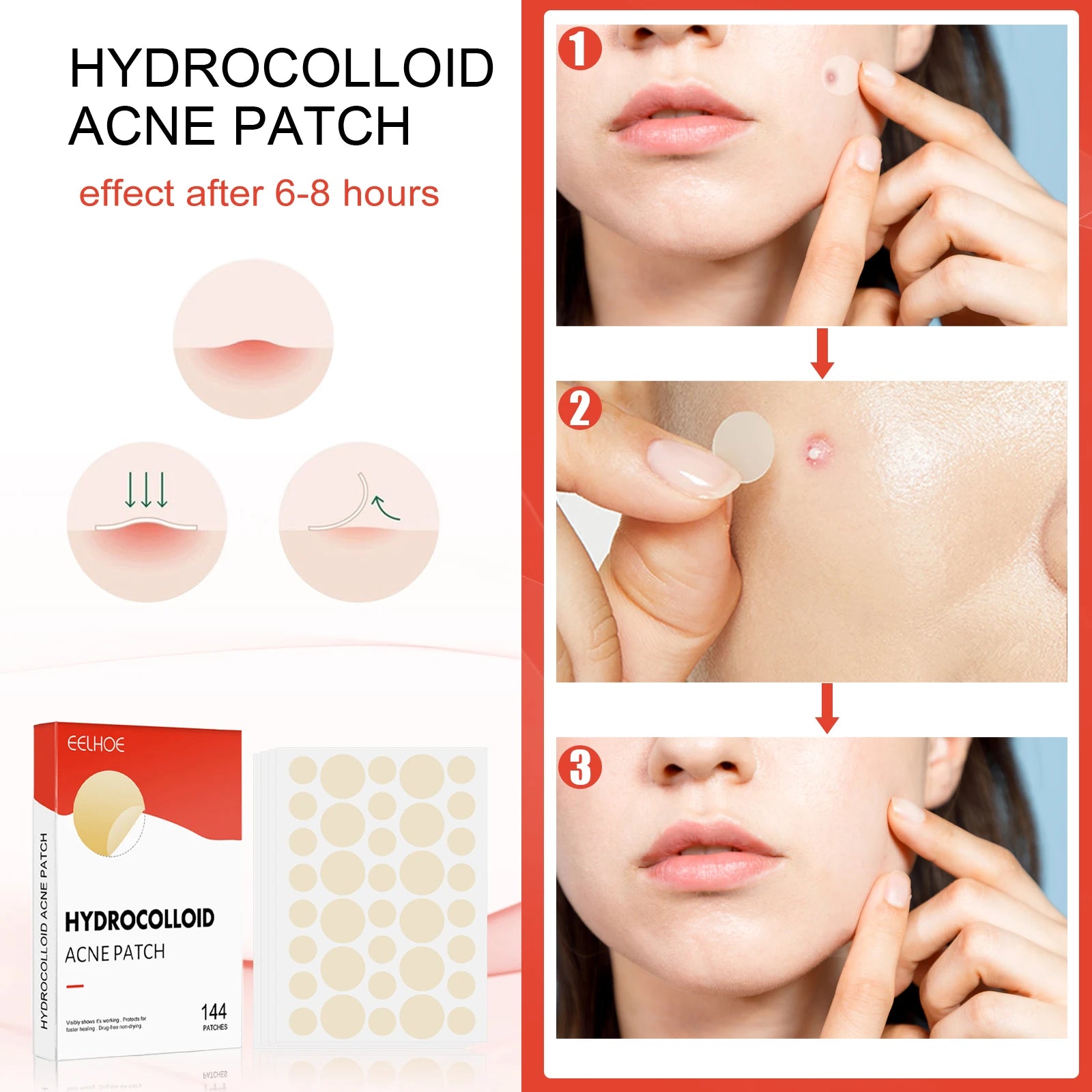 Hydrocolloid Acne Patches - 144 Count Invisible Blemish Patch, Ultra-Thin Skin Care Stickers for Gentle Blemish Care