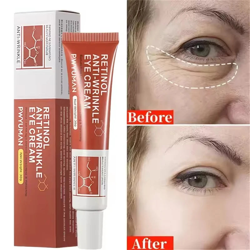 Fat Granules Removal Eyestick Anti-Puffiness Firming Cream Anti Inflammatory Fade Fine Line Repair Skin Barrier Korean Skin Care