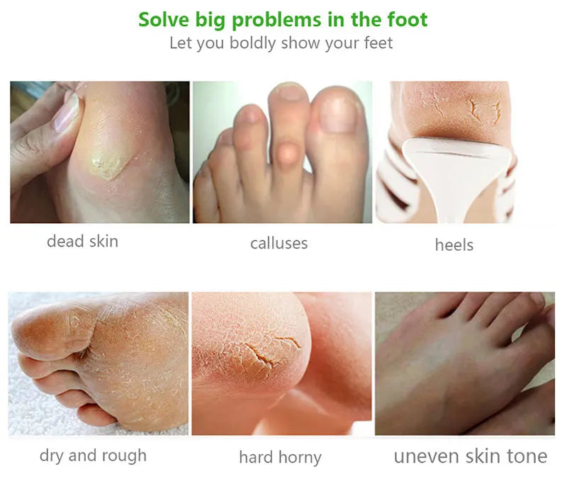 1-10Pcs Exfoliating Foot Mask Foot Spa Pedicure Socks Removing Dead Skin Whitening Heels Peeling Anti Cracked Foot Skin Care