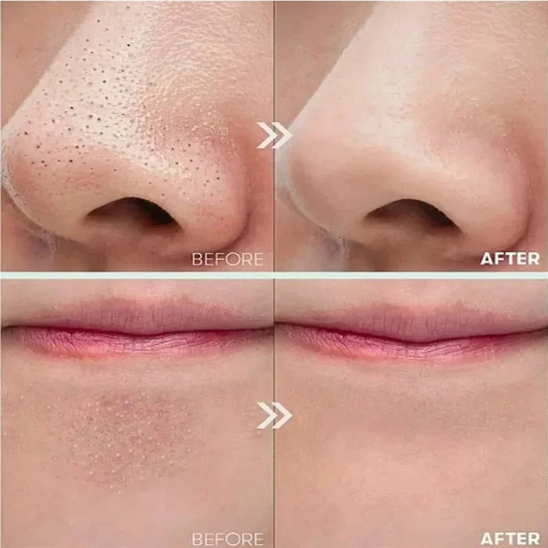 White Black Rice Exfoliating Serum Peel Shot Facial Moisturizing Soften Blackhead Removal Hydrating Shrink Pores Skin Care Korea