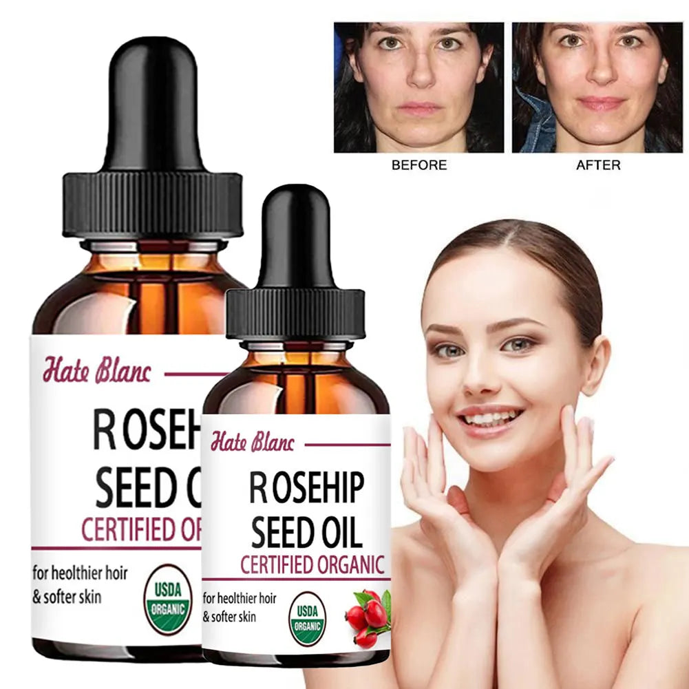Moisturizing Rosehip Oil Oil Massage Skin Care Plant Essential Oil Moisturizing Whitening Essential Oil