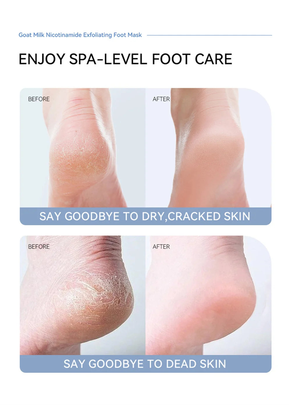 Exfoliating Foot Mask Feet Peeling Mask Spa Socks Smooth Dead Skin Remover Moisturizing Whitening Anti-Cracked Foot Skin Care