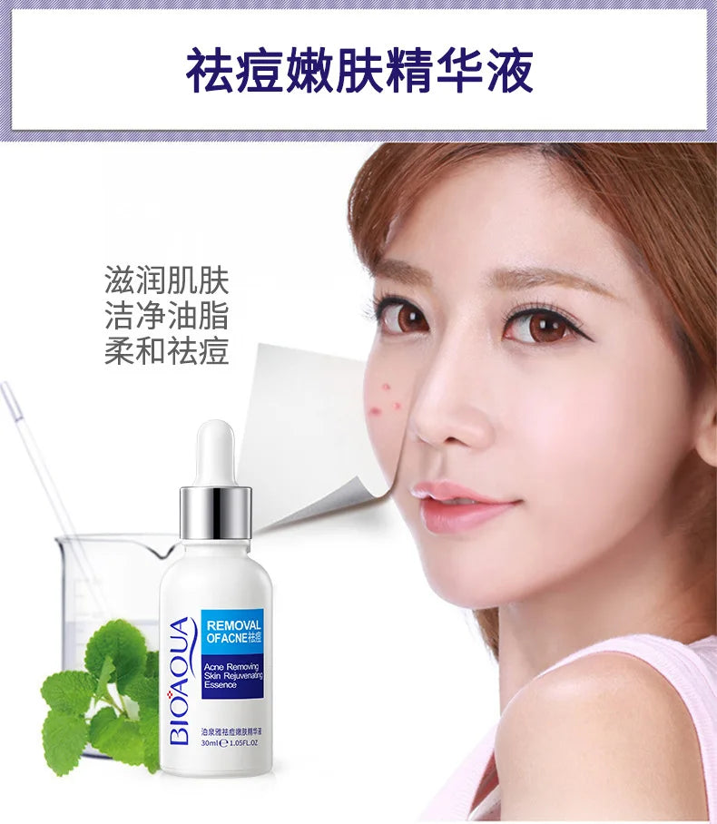 Treatment Cream Face Acne Remover Repair Gel Oil Control Serum Shrink Pores Whitening Facial mask Skin Care Korean Cosmetic