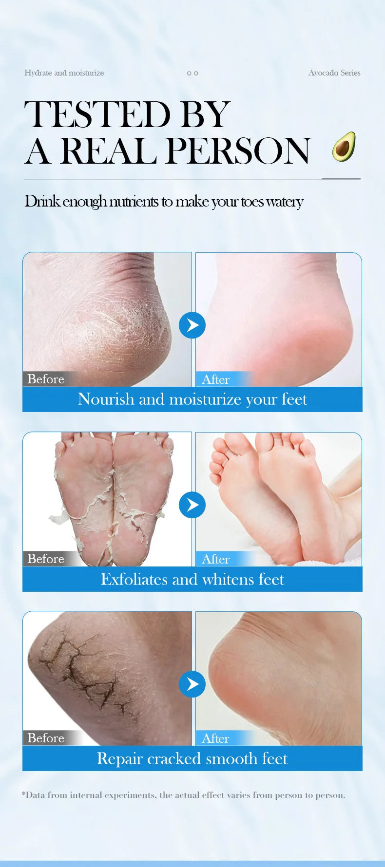 1/3/5 Pairs Avocado Exfoliating Foot Mask Feet Pedicure Remove Dead Skin Moisturizing Foot Exfoliator Feet Masks Skin Care