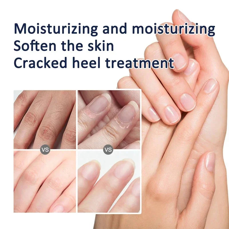 Wrinkle Removal Hand Cream Skin Soften Nourish Anti Drying Cracked Fade Fine Lines Whitening Moisturiz Repair Skin Care Products