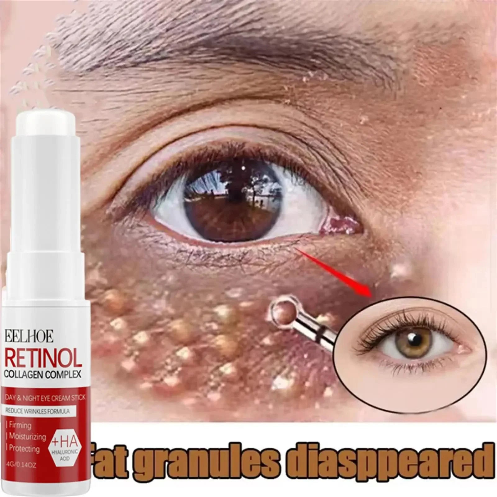 Fat Granules Removal Eyestick Anti-Puffiness Firming Cream Anti Inflammatory Fade Fine Line Repair Skin Barrier Korean Skin Care