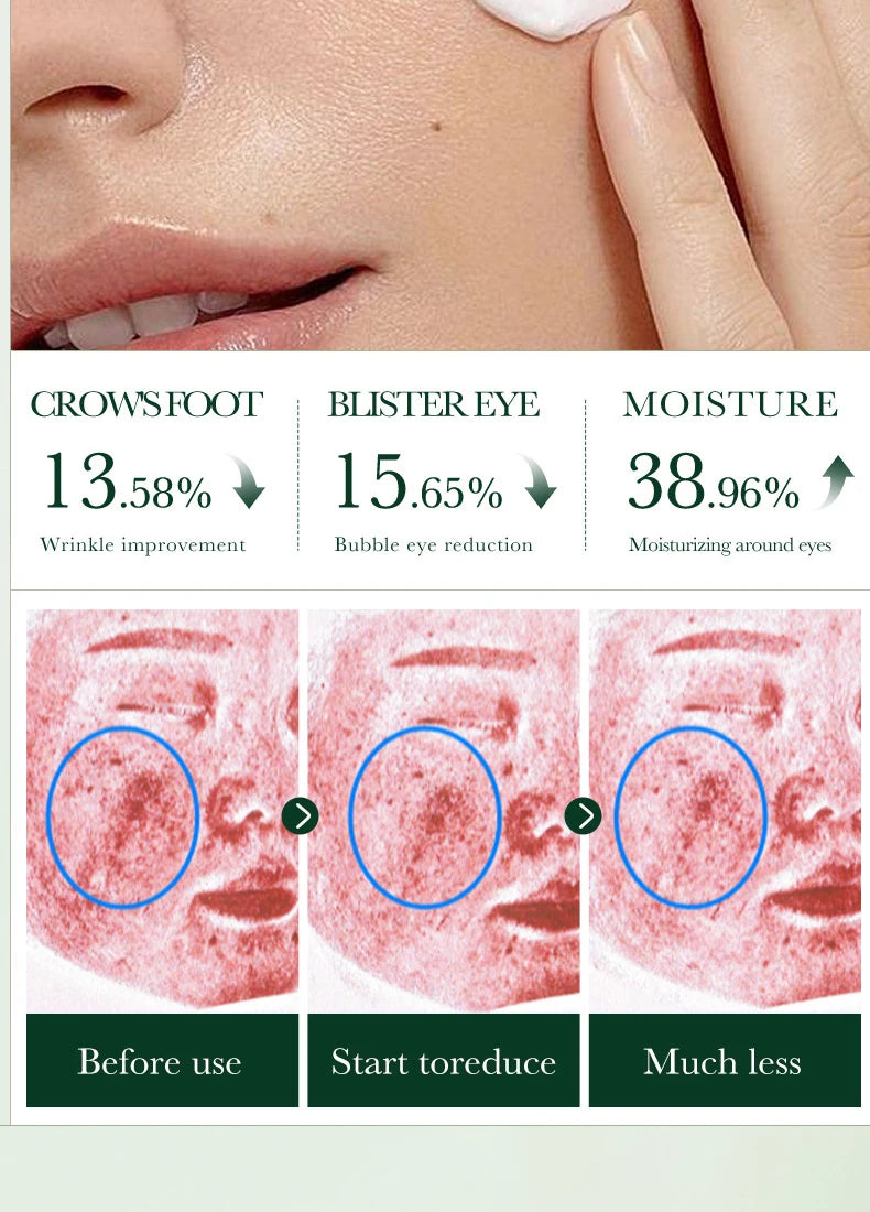 Tea Tree Acne Removing Cream Facial skincare Oil Control Face Gel Creams Hydrating Moisturizing Facial Cream Skin Care Set