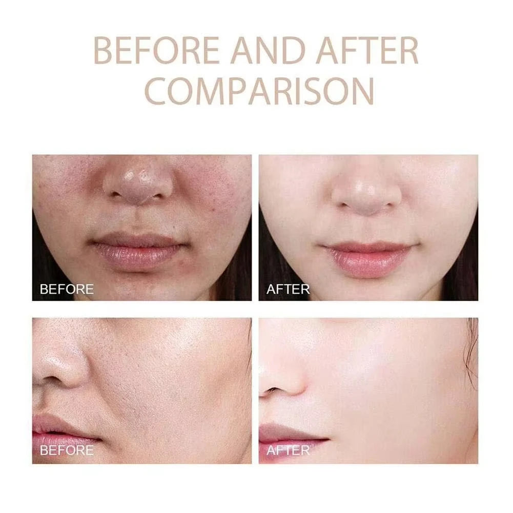 Rice Exfoliating Serum Facial Moisturizing Soften Serum Blackhead Removal Hydrating Pore Shrinking Korean Skin Care