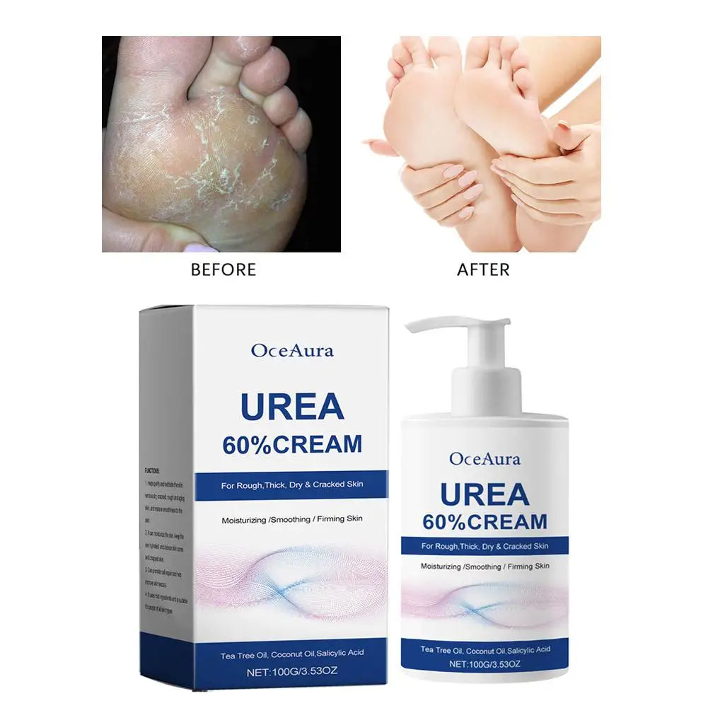 Urea Care Foot Cream Heel Repair Moisturizing Soft Relieve Drying Cracked Remove Calluses Dead Skin Removal Hand Foot Skin Care