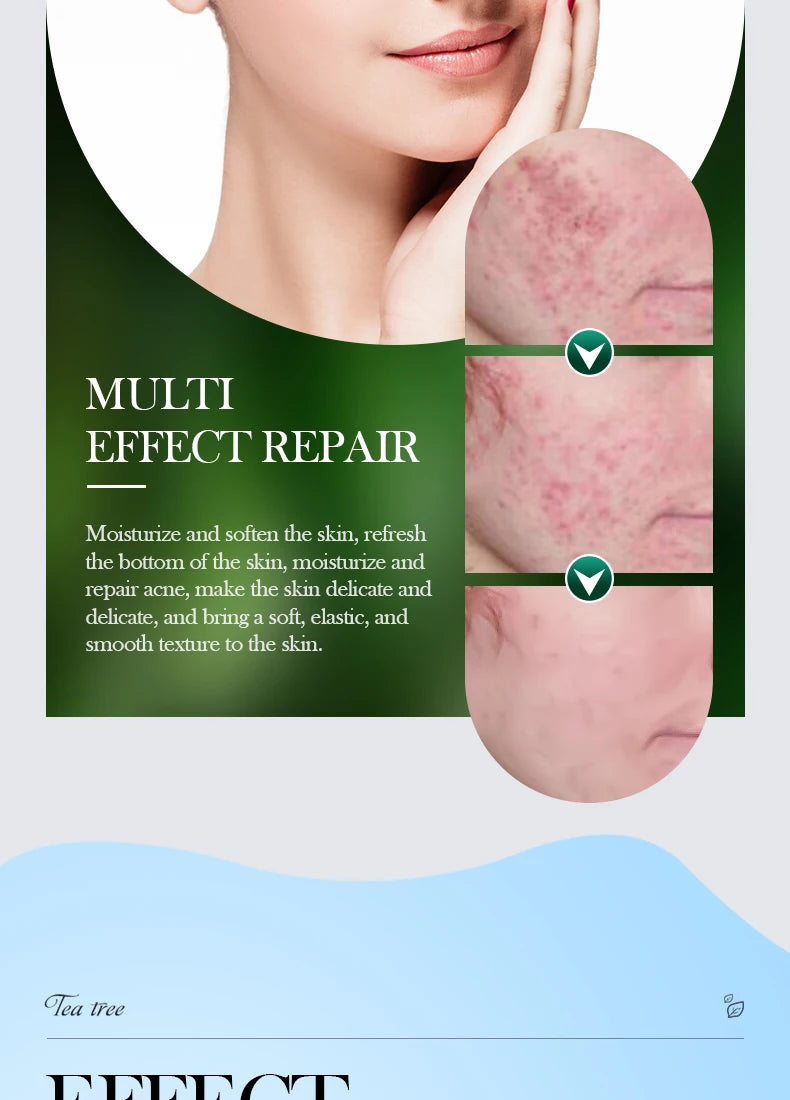 Tea Tree Acne Removing Cream Facial skincare Oil Control Face Gel Creams Hydrating Moisturizing Facial Cream Skin Care Set