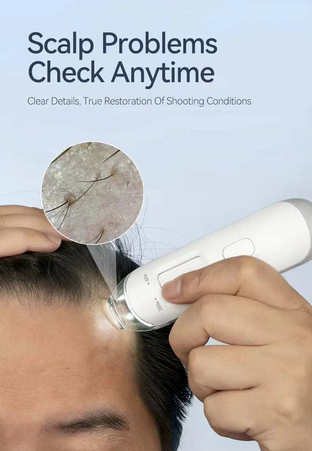 New Skin Hair Scalp Detector Dermatoscope Tester Digital HD 50X /200X Skin Analyzer Machine For Scalp Diagnostic Skin Care Tools