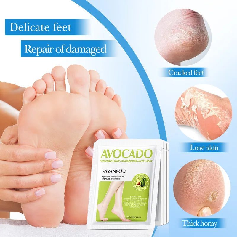 1/3/5 Pairs Avocado Exfoliating Foot Mask Feet Pedicure Remove Dead Skin Moisturizing Foot Exfoliator Feet Masks Skin Care