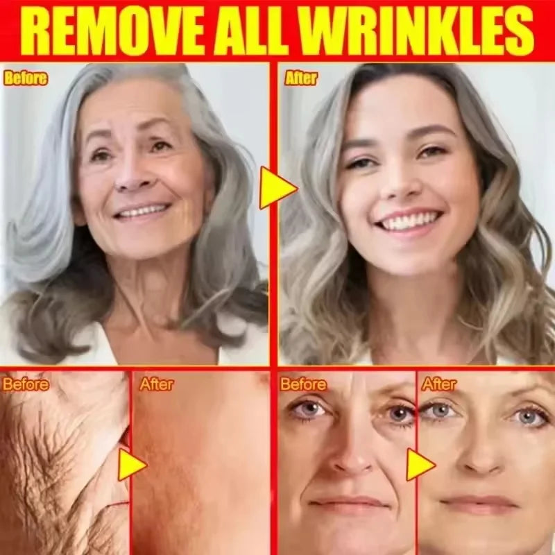Hyaluronic Acid Instant Wrinkle Remover Essence Fade Fine Lines Face Serum Anti Aging Firming Lifting Whitening Korean Skin Care