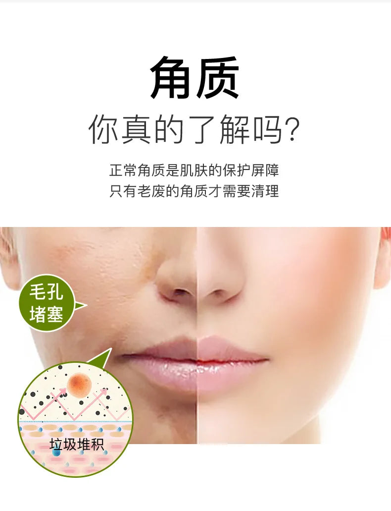 Exfoliating Peeling Gel Facial Scrub Moisturizing Whitening Nourishing Repair Scrubs Face Cream Beauty Skin Care