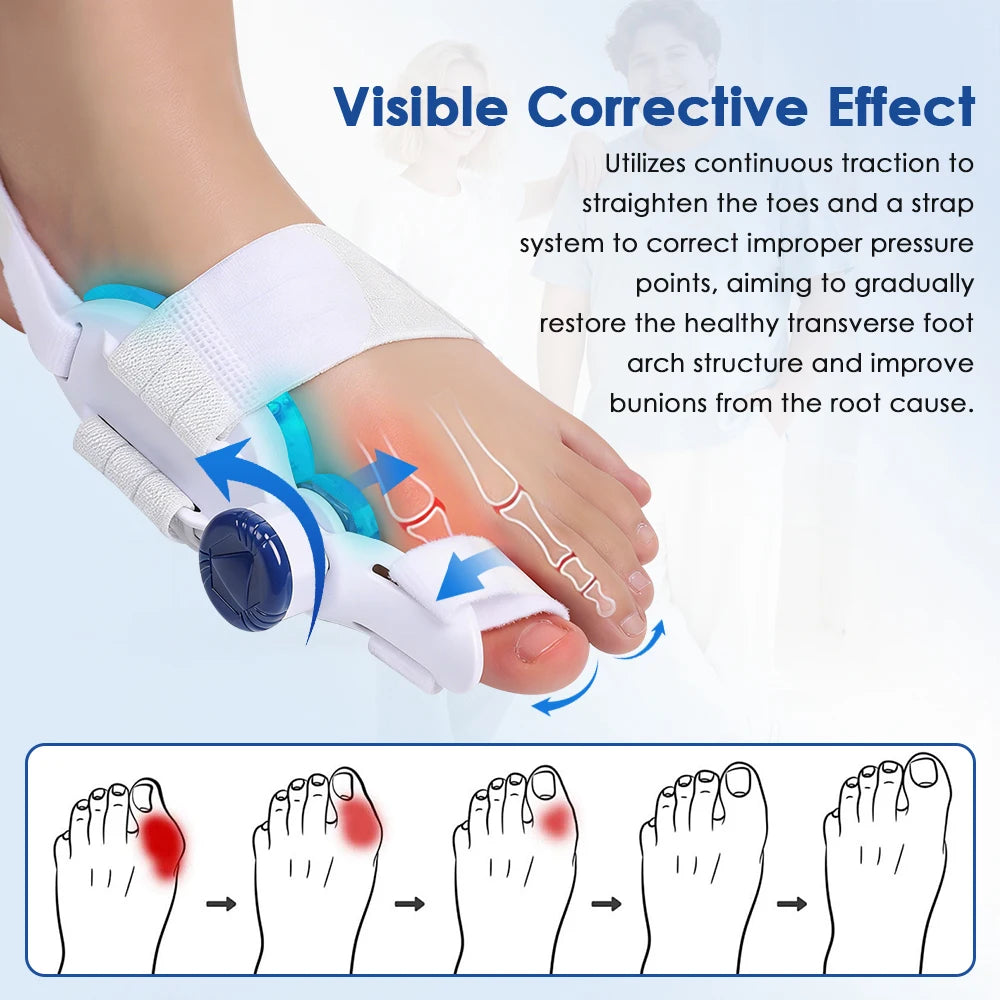 Toe Splint Bunion Corrector with Cooling Pad Adjustable Big Toe Valgus Correct Tool for Both Feet Straightening Orthopedic Thumb