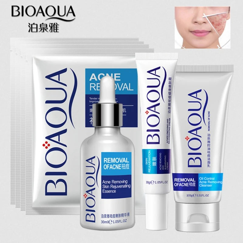Treatment Cream Face Acne Remover Repair Gel Oil Control Serum Shrink Pores Whitening Facial mask Skin Care Korean Cosmetic