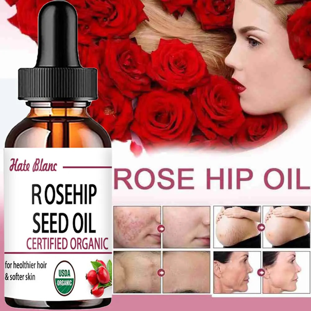 Moisturizing Rosehip Oil Oil Massage Skin Care Plant Essential Oil Moisturizing Whitening Essential Oil