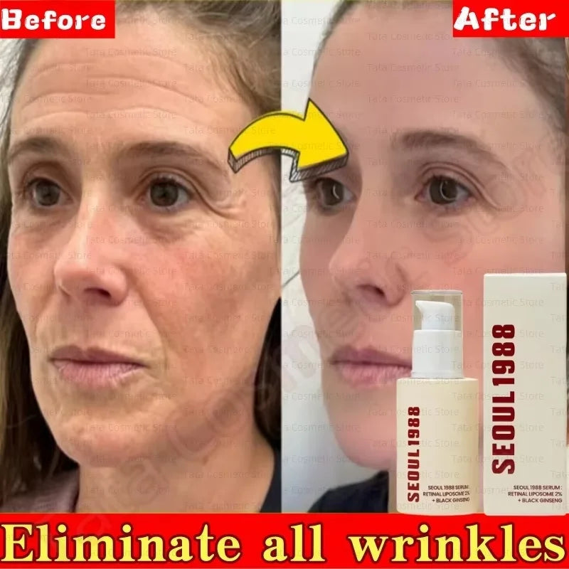 Korean SEOUL 1988 Serum Black Ginseng 2%Retinal Anti Aging Wrinkle Firming Pores Brightening Nicotinamide Balancing Skin Care