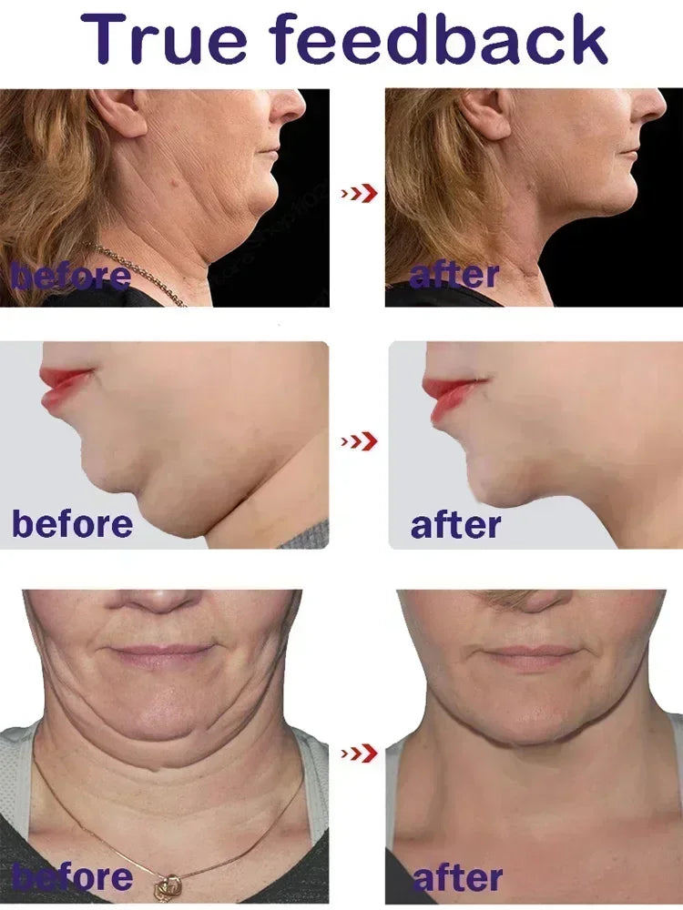 3RD  V-Shape Face Slimming Lifting Facial Cream Lift Up V Double Chin Cheek Slimming Firming Anti Wrinkle Beauty Skin Care
