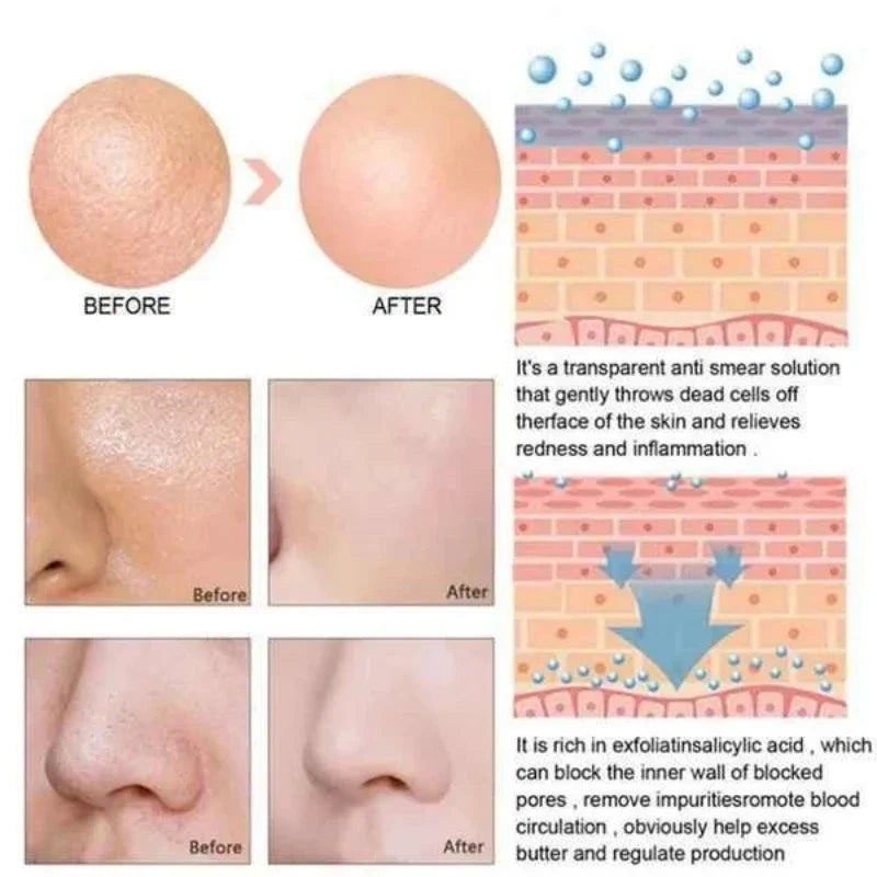 White Black Rice Exfoliating Serum Peel Shot Facial Moisturizing Soften Blackhead Removal Hydrating Shrink Pores Skin Care Korea