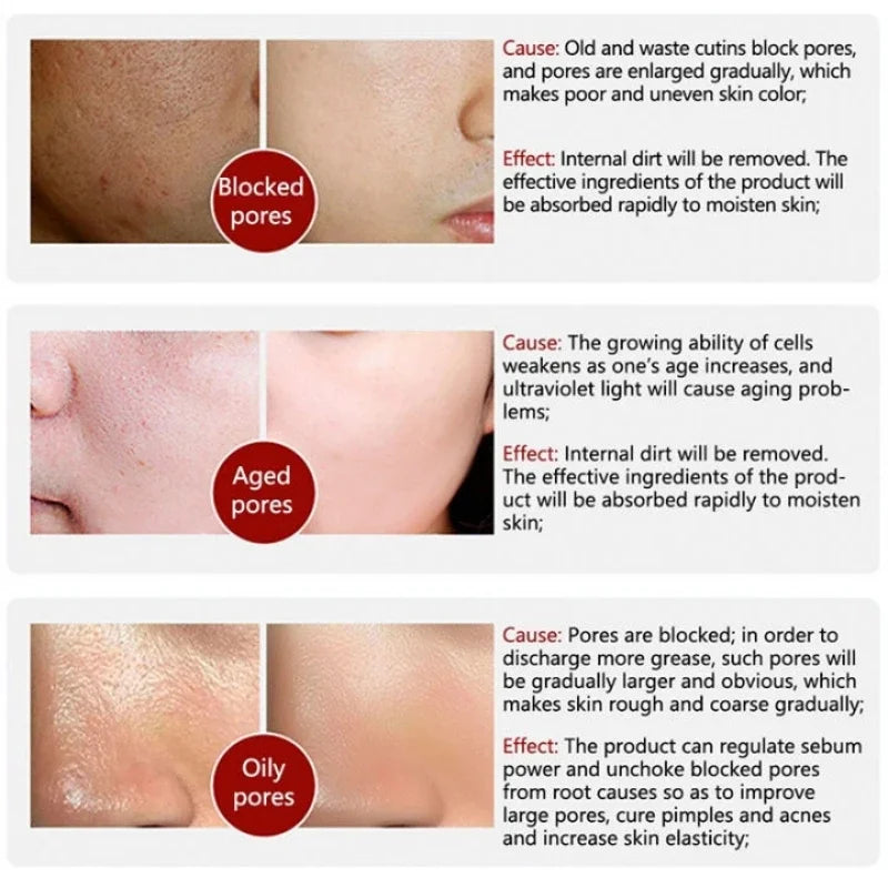 White Black Rice Exfoliating Serum Peel Shot Facial Moisturizing Soften Blackhead Removal Hydrating Shrink Pores Skin Care Korea