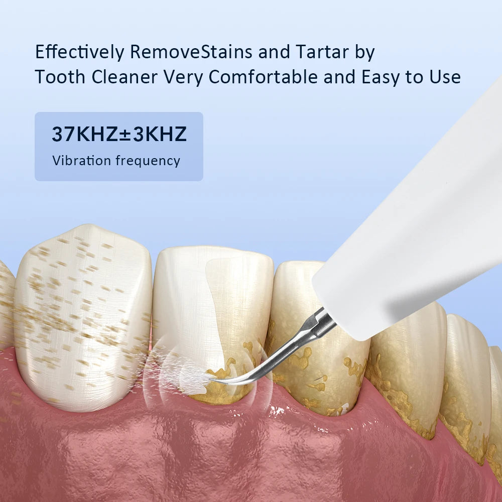 Electric Ultrasonic Teeth Tartar Cleaner Dental Scaler Tool for