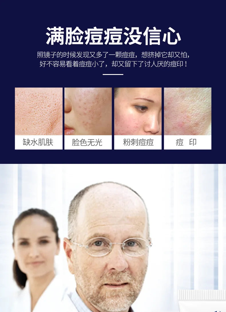 Treatment Cream Face Acne Remover Repair Gel Oil Control Serum Shrink Pores Whitening Facial mask Skin Care Korean Cosmetic