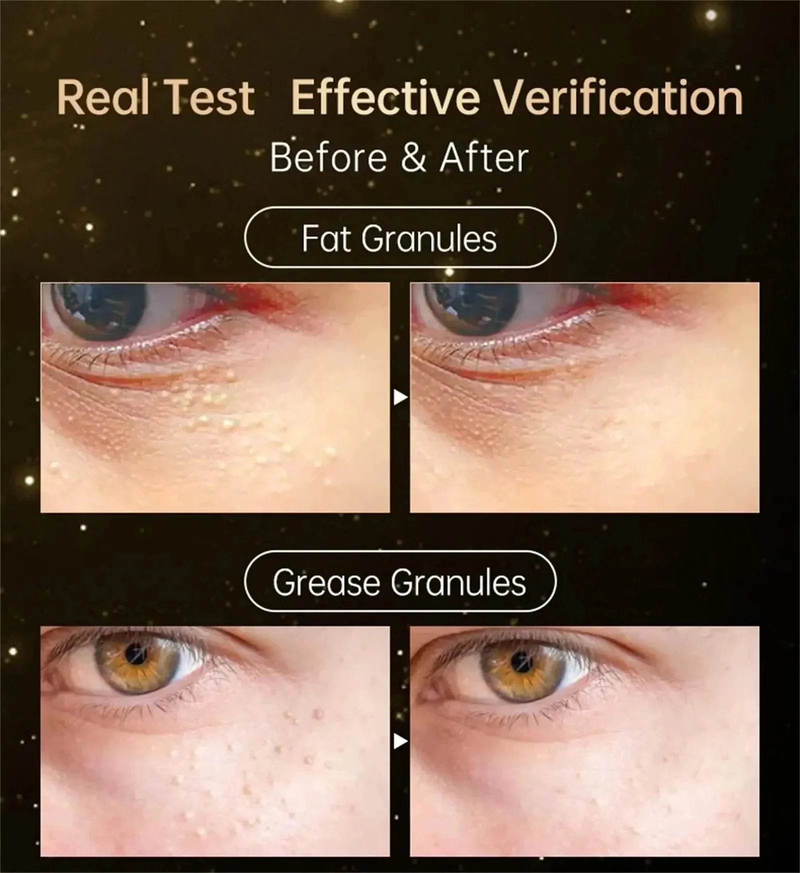 Fat Granules Removal Eyestick Anti-Puffiness Firming Cream Anti Inflammatory Fade Fine Line Repair Skin Barrier Korean Skin Care