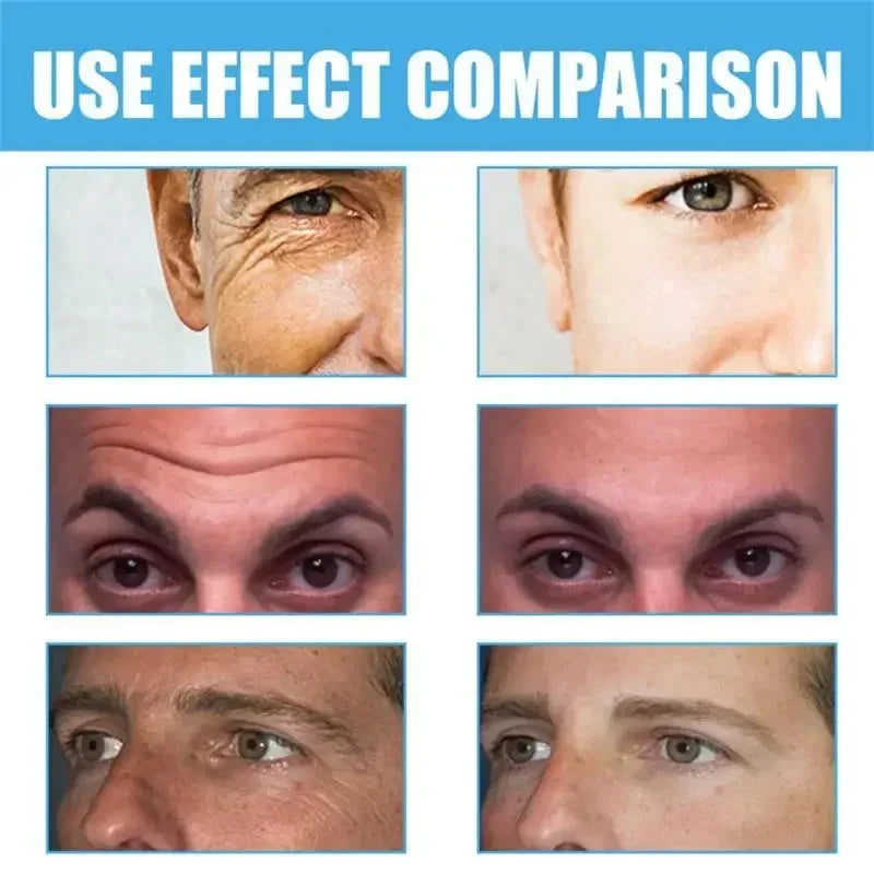 Retinol Anti-wrinkle Cream For Men Collagen Anti-Aging Removal Face & Neck Wrinkle Efficient Moisturize Firming Korean Skin Care