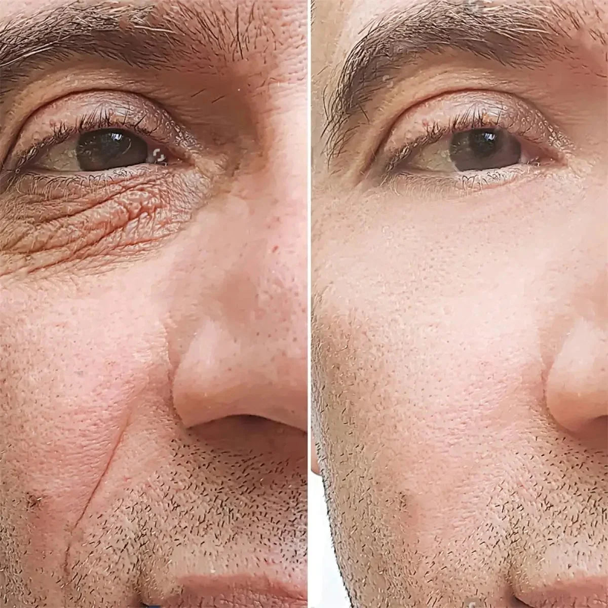 Men's Retinol Anti-Wrinkle Face Cream