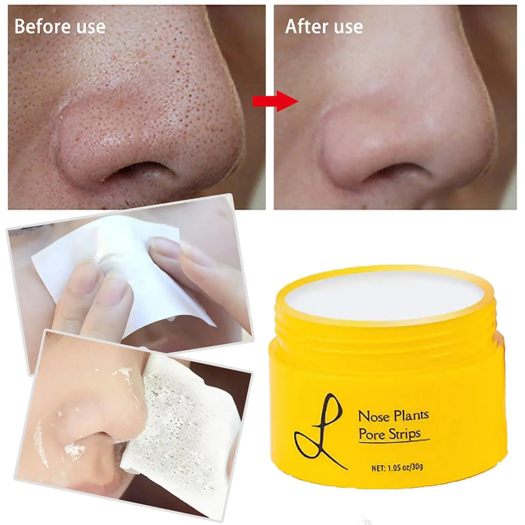 Deep Cleansing Nose Pore Strips Skin Care Firming Skin Blackhead Pimples Remover Purifying Peel Type for All Skin Types Skincare