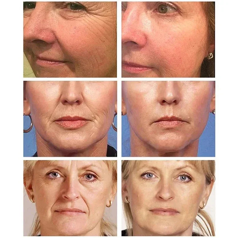 Retinol Anti-wrinkle Cream For Men Collagen Anti-Aging Removal Face & Neck Wrinkle Efficient Moisturize Firming Korean Skin Care