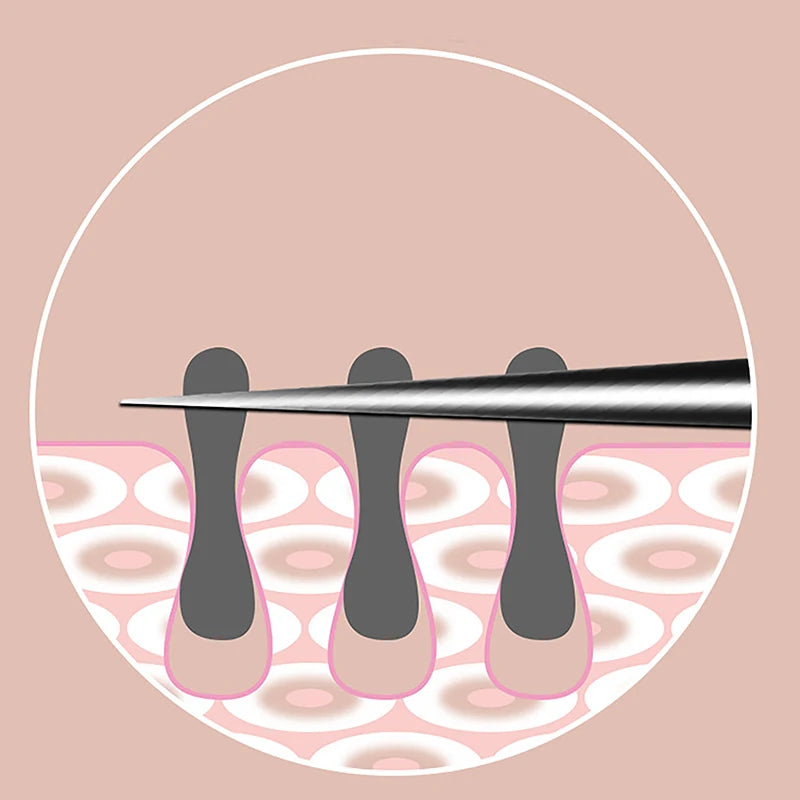 Cell Pimples Blackhead Remover Clip Ultra-fine Tweezers Black Dots Blackhead Extractor Acne Needle Facial Cleaner Skin Care Tool