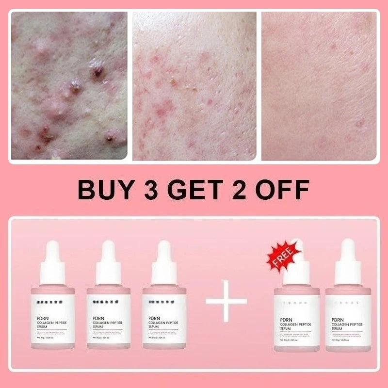 Collagen Peptide Facial Serum for Dull Skin Boosts Elasticity