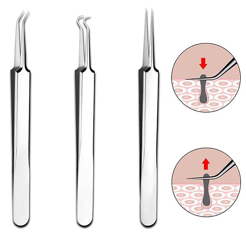 Cell Pimples Blackhead Remover Clip Ultra-fine Tweezers Black Dots Blackhead Extractor Acne Needle Facial Cleaner Skin Care Tool