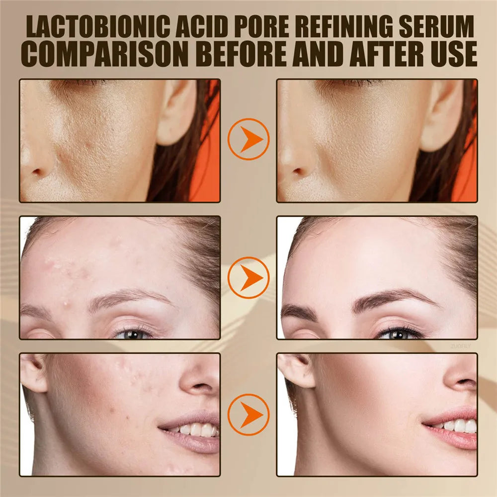 EELHOE Lactobionic Acid Pore Shrink Face Serum Skin Repair Clean Blackheads Acne Skin Care Lasting Moisturizing Korean Cosmetic