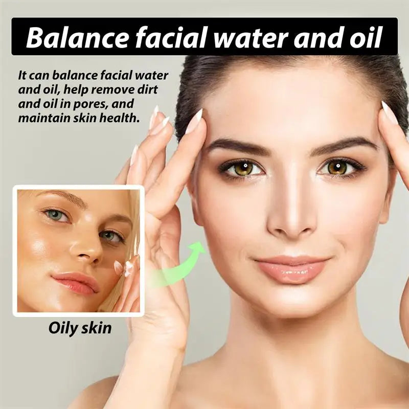 Natural Herbs Acid Acne Cream Shrink Pores Blackheads Scars Acne Marks Blemishes Oil Control Whitening Korean Skin Care Products