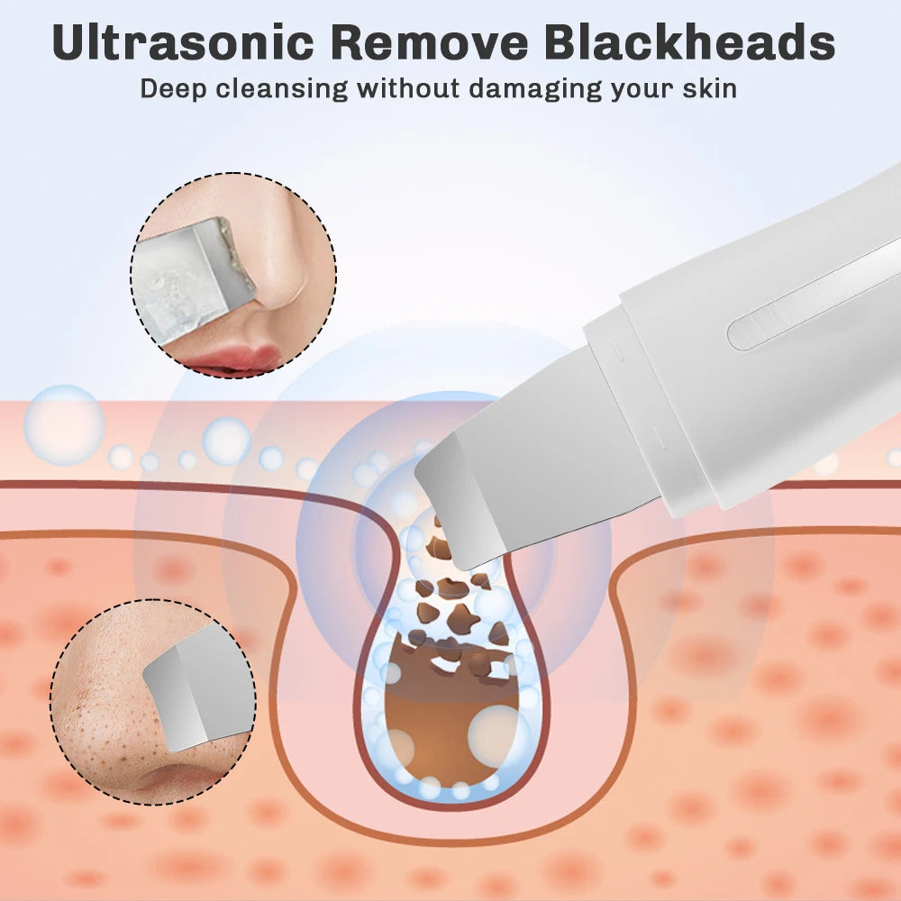 Ultrasonic Skin Scrubber Red Blue Light Deep Face Cleaning Peeling Blackhead Remover Facial Shovel Cleanser Lifting Skin Care