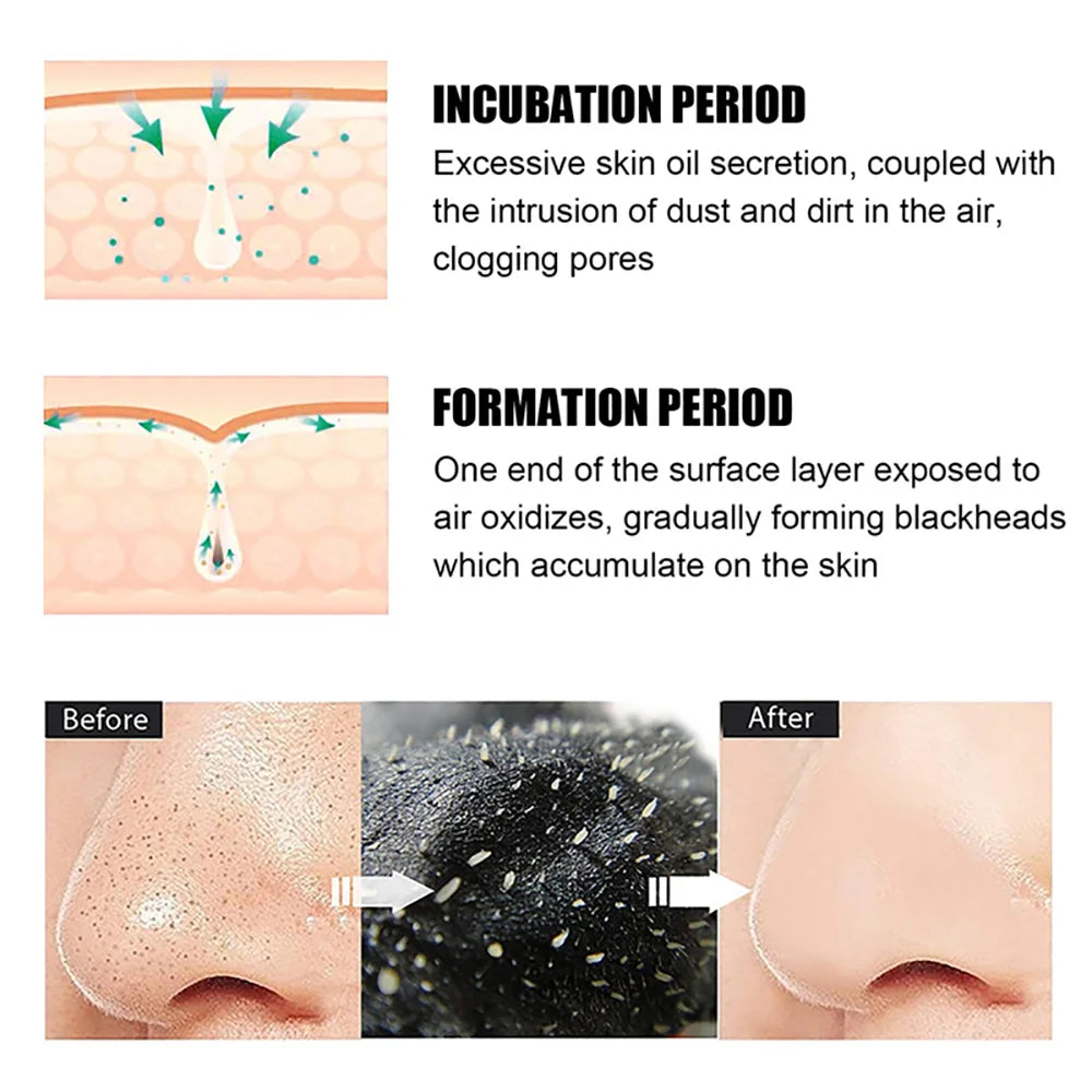 10/20/50/100PCS Nose Blackhead Remover Mask Shrink Pore Acne Treatment Sticker Black Dots Strips Nose Deep Cleansing Skin Care