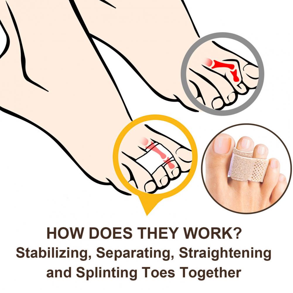 Toe Straightener Breathable Bunion Corrector Non-Deformed Foot Wear Finger Straightener Hammer Toe Hallux Valgus Corrector