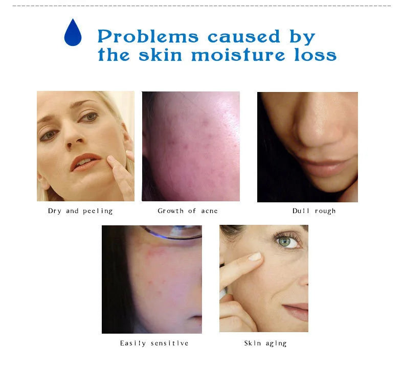 ARTISCARE Hyaluronic Acid Face Serum 5pcs for Moisturizing and  Brighten Long-Lasting Hydrating Skin Care Essence