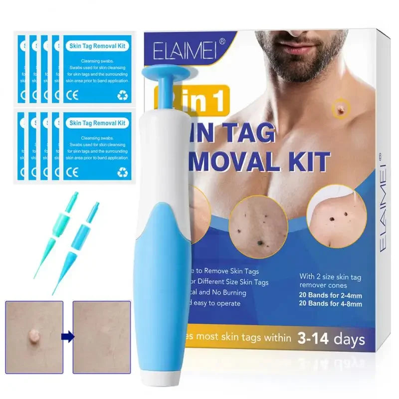 Auto Skin Tag Mole Wart Removal Face Skin Care Body Kit Painless Cleaning Tool Wart Dot Treatment for 2-8mm Beauty Health 2 In1