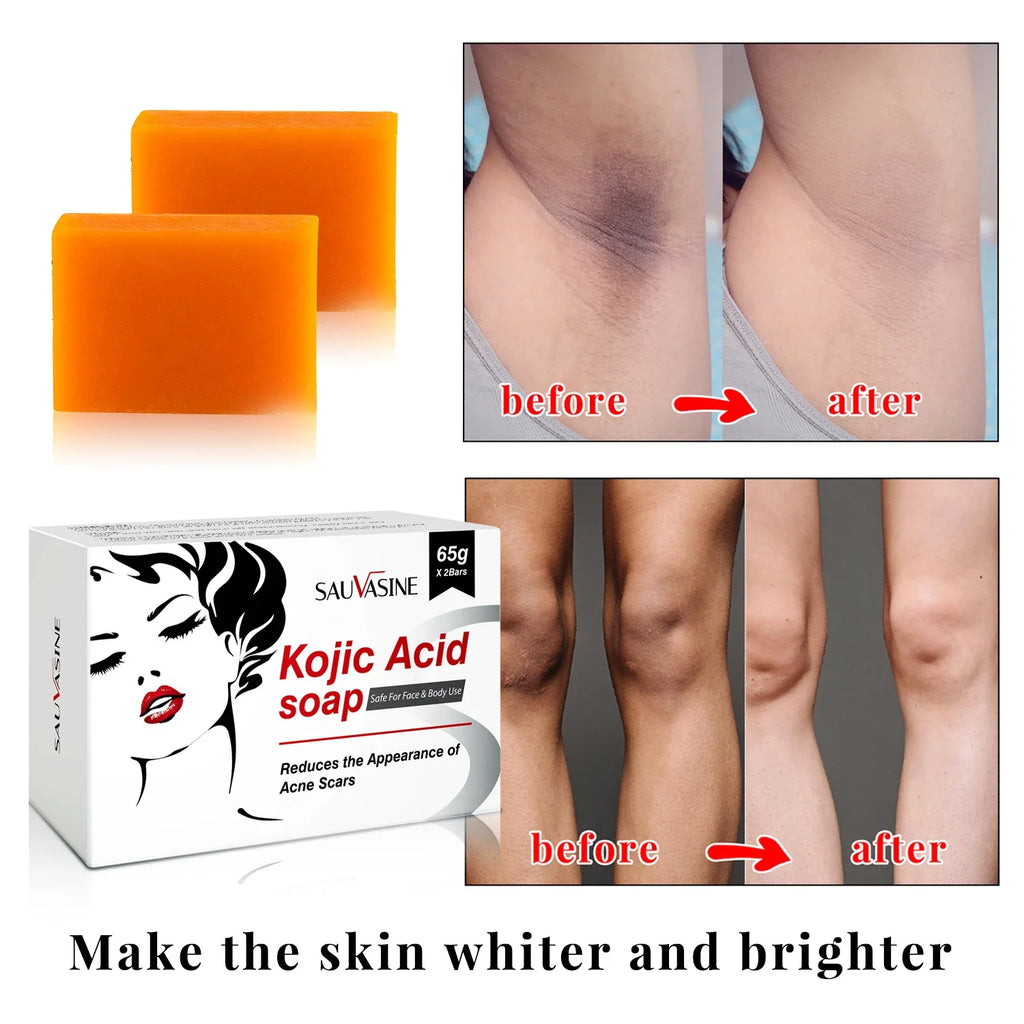 Kojic Acid Glow Soap Facial Deep Cleaning Even Skin Tone Skin Lightening Soap Oil Control Moisturizing Skin Care Soap for Men