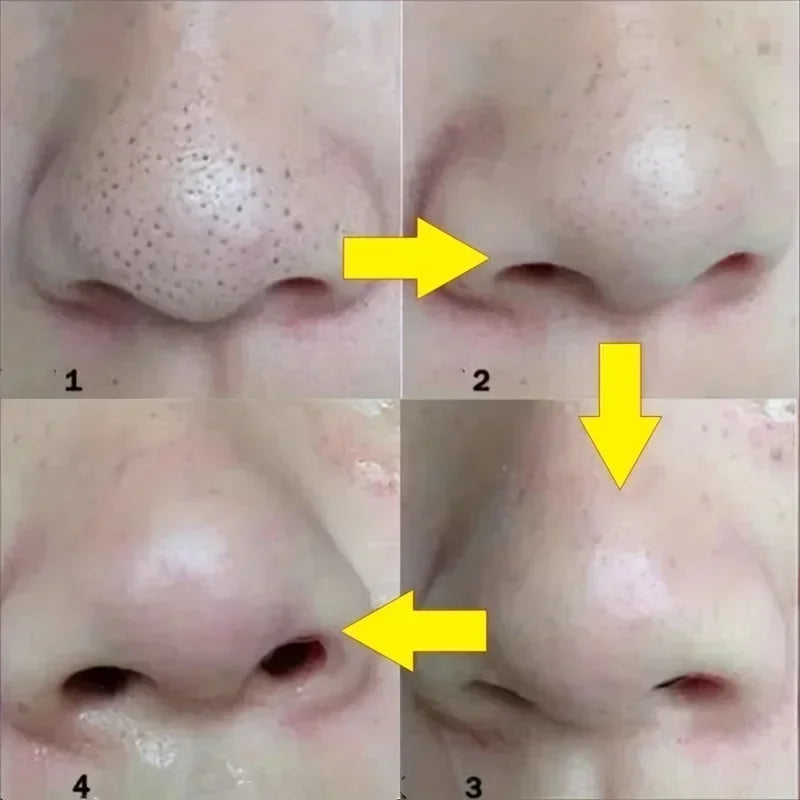 Nose Blackhead Remover Mask Nasal Strips Black Head Nose Dot Spot Peel Skin Care Shrink Pore Black dots Pore Clean Strips