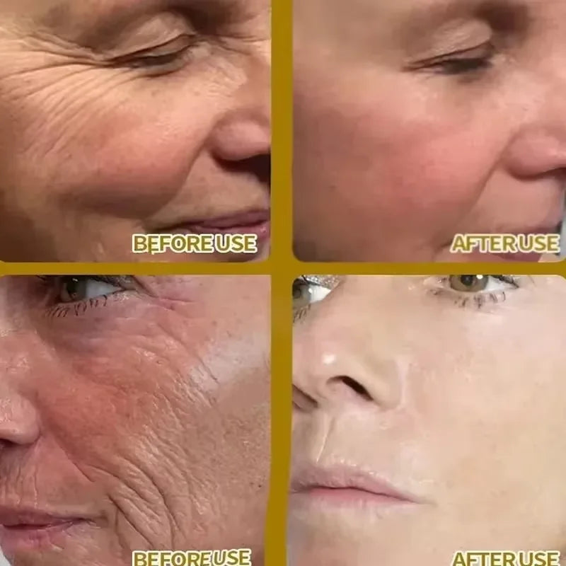 Korean SEOUL 1988 Serum Black Ginseng 2%Retinal Anti Aging Wrinkle Firming Pores Brightening Nicotinamide Balancing Skin Care